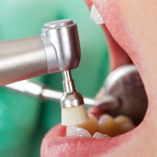 Zobu higiēnas process