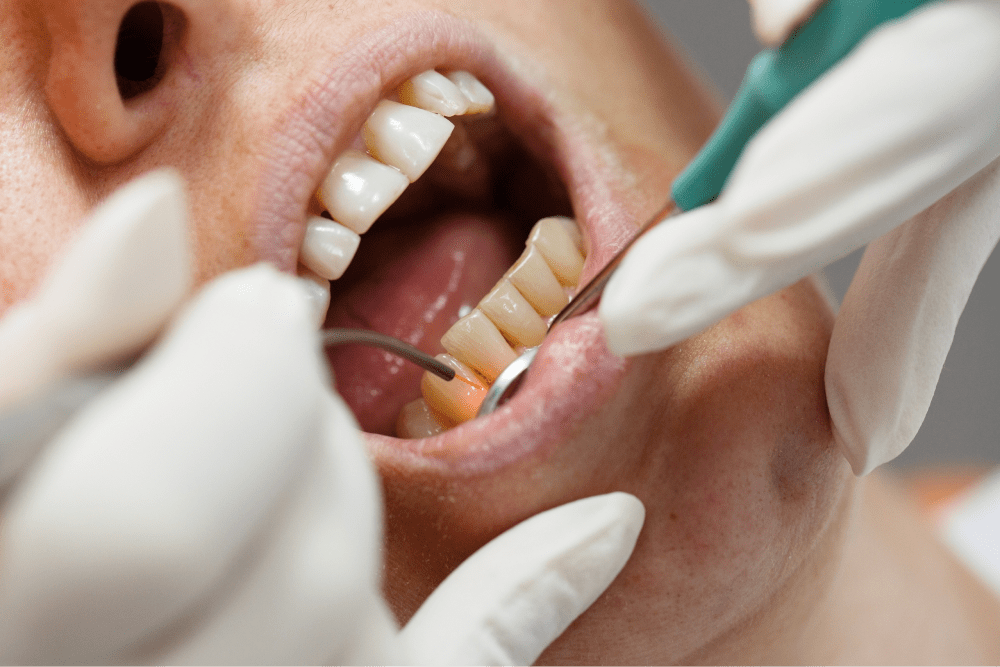 “21. gadsimta zobārstniecība, kas ar lāzera precizitāti risina smaganu problēmas”