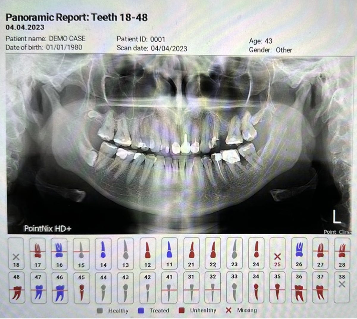 Revolūcija zobārstniecībā: Mutes dobuma diagnostika ar mākslīgā intelekta palīdzību
