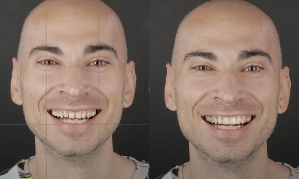 2d-before-after-1