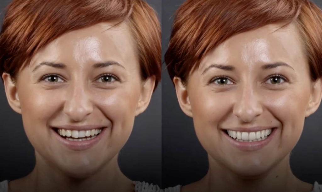 2d-before-after-2